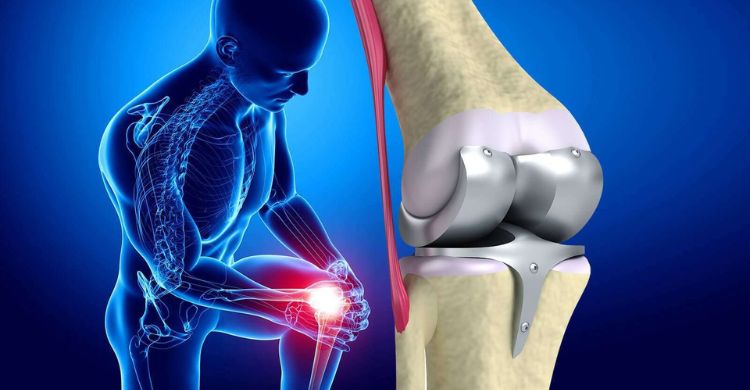 Contact Dr. Dhruv Patel for knee replacement Surgery Specialist in Navi Mumbai, Vashi & Belapur